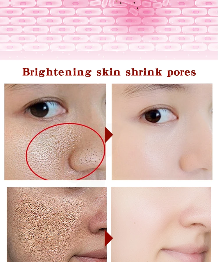 Cele mai bune de ingrijire a pielii pentru acnee imbatranire a pielii predispuse
